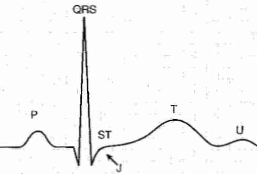 [ Normal electrocardiogram ]