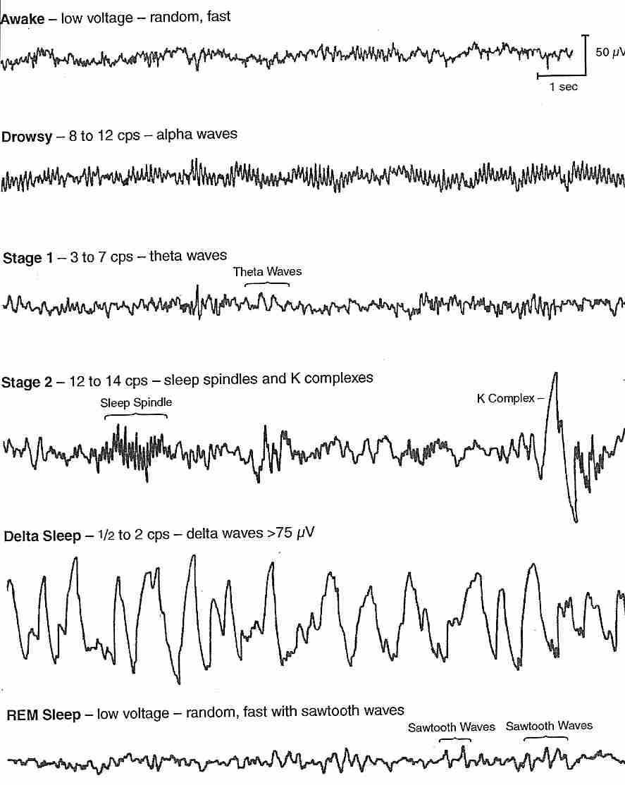 EEGs when Awake and Asleep