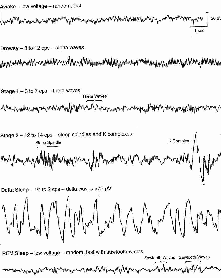 Pattern-House: sleep pattern